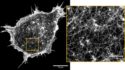 Super-resolution image of the actin cortex of fixed HEK cells on a glass coverslip Super-resolution image of the actin cortex of fixed HEK cells on a glass coverslip