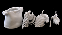 Lung phantoms resulting from the collaboration Lung phantoms resulting from the collaboration
